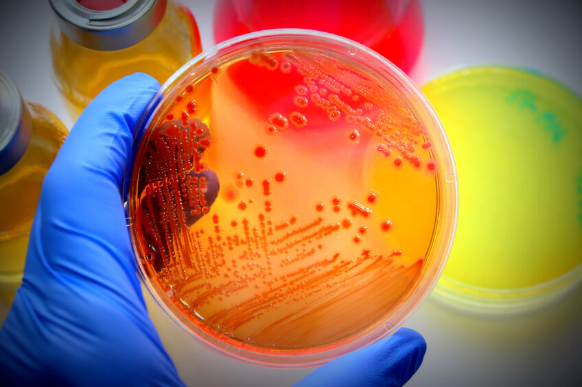 Microbiology Testing Services